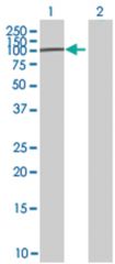  LOC126295 293T Cell Overexpression Lysate (Denatured), Abnova