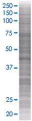  ASB6 293T Cell Overexpression Lysate 2 (Denatured), Abnova