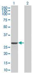  ASB7 293T Cell Overexpression Lysate (Denatured), Abnova