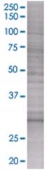 ASB9 293T Cell Overexpression Lysate (Denatured), Abnova