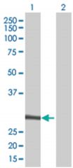  NFAM1 293T Cell Overexpression Lysate (Denatured), Abnova
