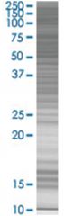  ZNF596 293T Cell Overexpression Lysate (Denatured), Abnova