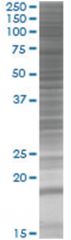  NUDT10 293T Cell Overexpression Lysate (Denatured), Abnova