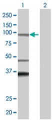  ADAM32 293T Cell Overexpression Lysate (Denatured), Abnova