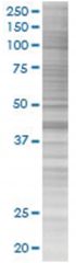  NEIL2 293T Cell Overexpression Lysate (Denatured), Abnova