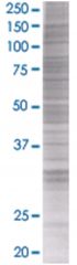  ANGPTL5 293T Cell Overexpression Lysate (Denatured), Abnova