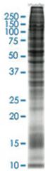  IMR-32 (human neuroblastoma) Whole cell lysate, Non-denatured; Abnova