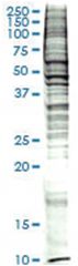  Raw 264.7 (mouse macrophage, Abelson murine leukemia virus transformed) Nuclear extract lysate, Denatured; Abnova